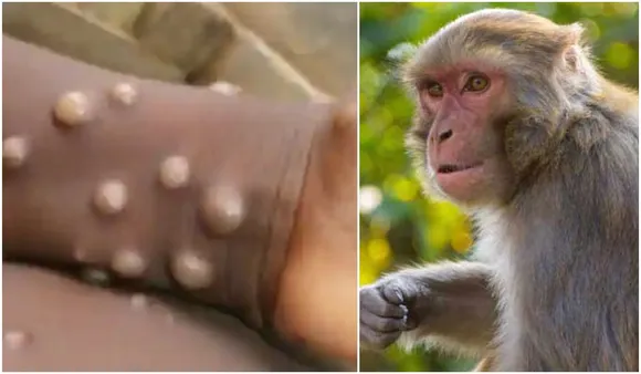 10 Things To Know About The Deadly Monkey B Virus