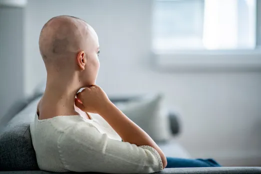 Experimental Cancer Treatment Said To Prevent Hair Loss During Chemo