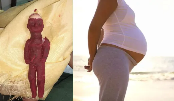 Uttar Pradesh Woman Fakes Pregnancy Using Painted Plastic Doll