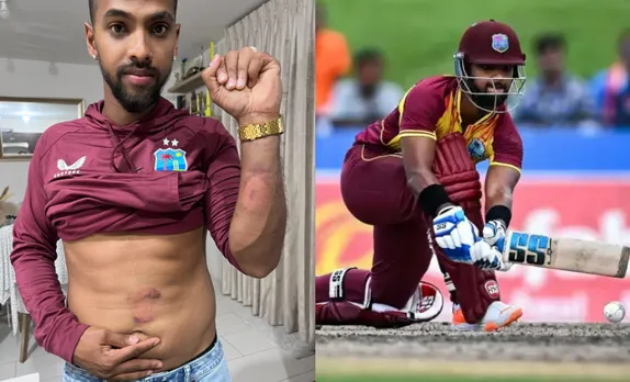‘Mard ko dard nahi hota’ - Fans react to viral image of Nicholas Pooran with bruises off Arshdeep Singh’s delivery and Brandon King’s shot after 5th T20I win vs India
