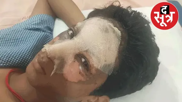 Minor fabricated false story acid attack