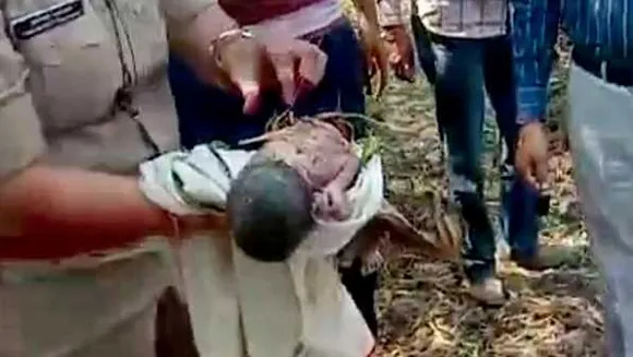 राजगढ़: एक दिन की बच्ची को झाड़ी में फेंका, महिला पुलिस ने बच्ची के शरीर से निकाले कांटे