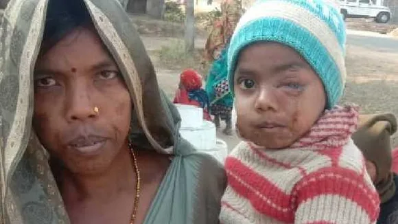 खूब लड़ी मर्दानी: बेटे को जबड़े में दबाए हुए था तेंदुआ, डंडा लेकर भिड़ गई मां, बच्चे को बचाया
