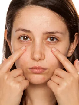 dark circles 2 - unsplash (1)