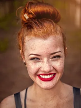 pimples - unsplash (1)