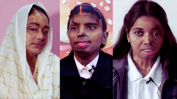 Acid Attack Survivors