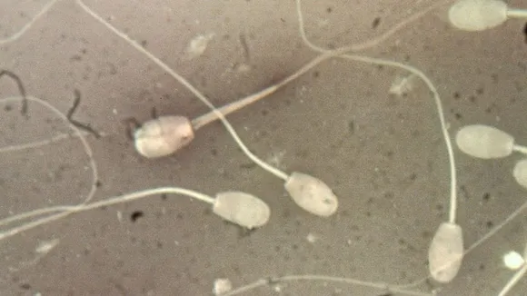 Microplastics Found in Human and Dog Testicles, Raising Fertility Concerns