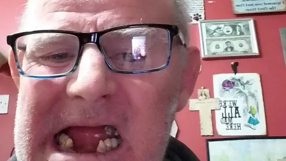 Cork Man Considers Removing Own Teeth with Pliers Due to Unaffordable Dental Surgery