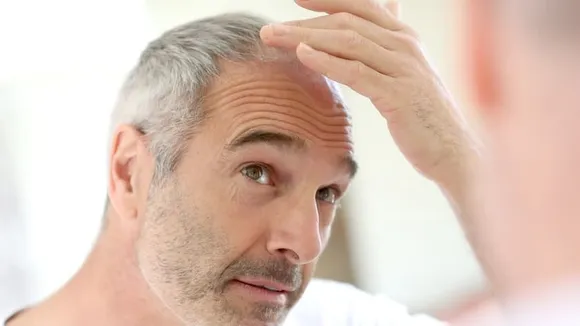 Scientists Explore Anti-Aging Treatments to Combat Graying Hair
