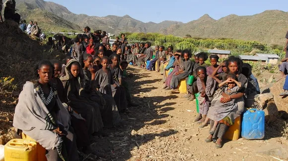 Ethiopia's Inadequate Burn Care System Demands Urgent Reforms