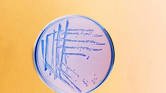Breakthrough Study Reveals How E. coli Causes UTIs