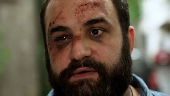 Georgian Opposition Politician Beaten Amid Protests Against 'Foreign Agents' Bill
