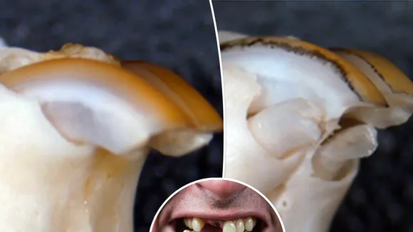 Japanese Researchers Aim to Enable Human Tooth Regrowth by 2030