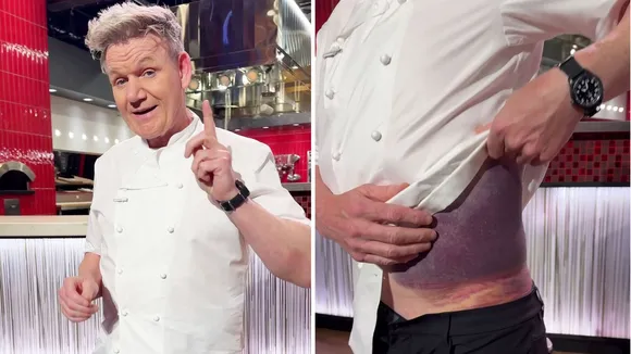 Gordon Ramsay Recovers After Serious Cycling Accident in the US