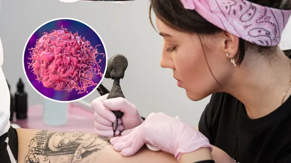 Study Links Tattoos to 21% Increased Risk of Rare Lymphoma