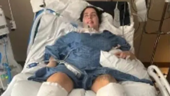 23-Year-Old Brazilian Woman Paralyzed After Eating Canned Soup in Colorado