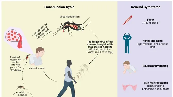 Study Identifies Key Risk Factors for Severe Dengue in Pakistan