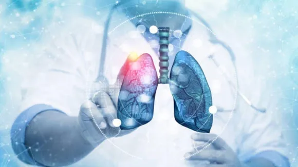 Asthma Cure Remains Elusive Despite Treatment Advances