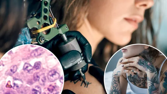 Study Links Tattoos to Increased Risk of Lymphoma by 21%