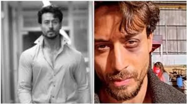 Tiger shroff suffers eye injury while shooting for Ganapath in UK , shares pic !