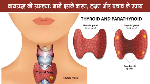 Thyroid problem Know its causes, symptoms and prevention measures