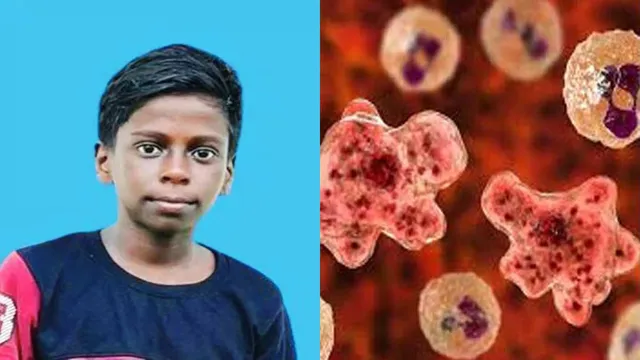 Mridul brain eating amoeba