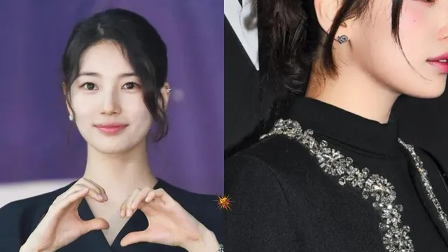 Suzy Gains Attention After Undergoing her Eyeball Surgery
