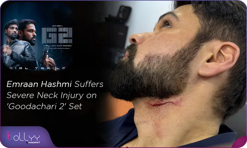 Emraan Hashmi Suffers Severe Neck Injury on 'Goodachari 2' Set