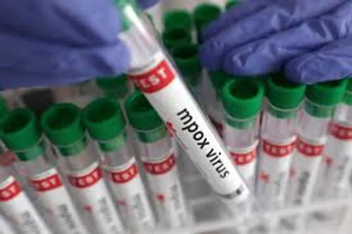 New York health department confirms first case of new mpox strain