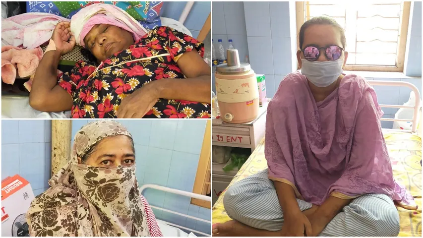 Three mucormycosis patients being treated at Sayaji Hospital discharged