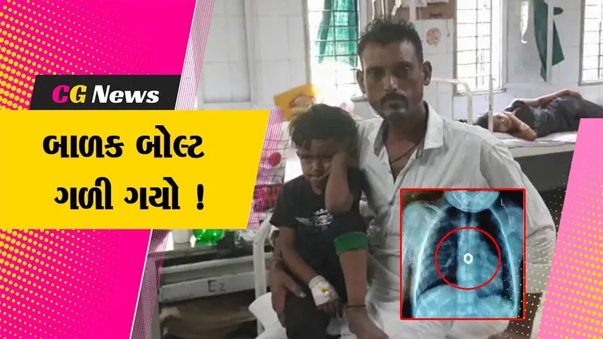 સુરત: વાલીઓ માટે લાલબતી સમાન ઘટના ! ઘરમાં રમતી વેળાએ બાળક બોલ્ટ ગળી ગયો