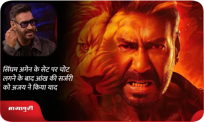 Ajay devgn recalls eye surgery after getting injured on the sets of Singham Again