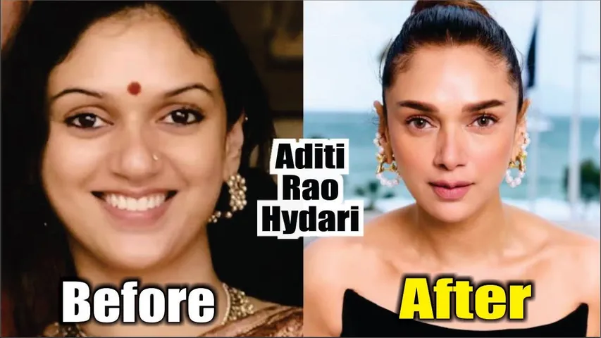 Heeramandi' Fame Aditi Rao Hydari's SHOCKING Before & After Photos Spark Plastic Surgery Rumours
