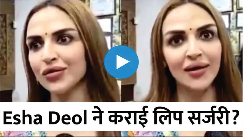 Esha Deol ने करवायी एक और सर्जरी? | Dhoom Actress Gets Trolled Post Lip Job | Esha Deol Lip Sugery