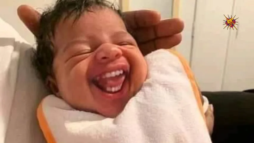 Baby Born with 32 Teeth: Viral Video Raises Awareness About Rare Condition