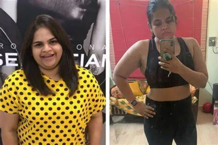 Weight Loss Surgery