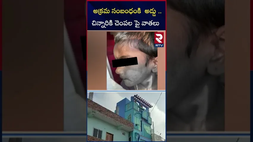 అక్రమ సంబంధంకి  అడ్డు ..చిన్నారికి చెంపల పై వాతలు | illegal relationship |Guntur |Sattenapalli |RTV