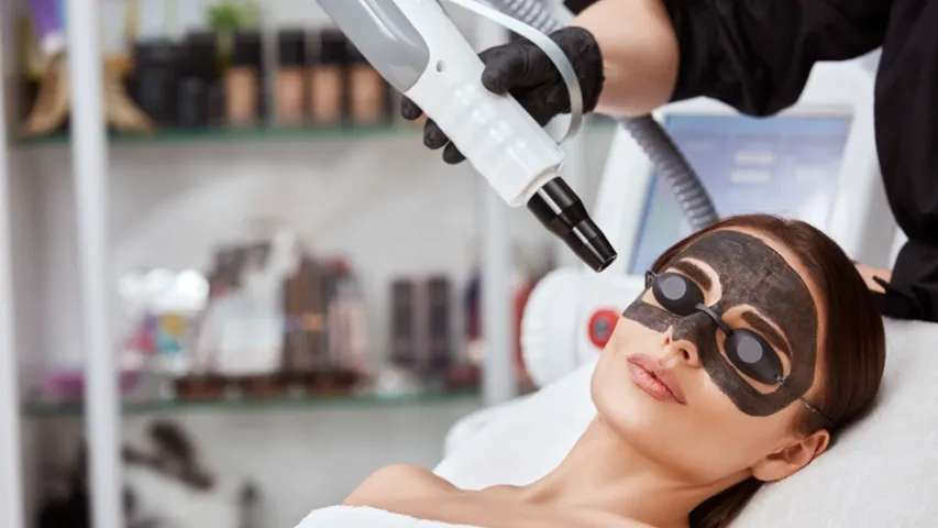 carbon facials