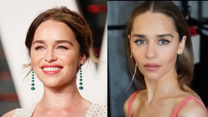 Game of Thrones' actress Emilia Clark is missing 'quite a bit' of her brain  after aneurysm surgeries