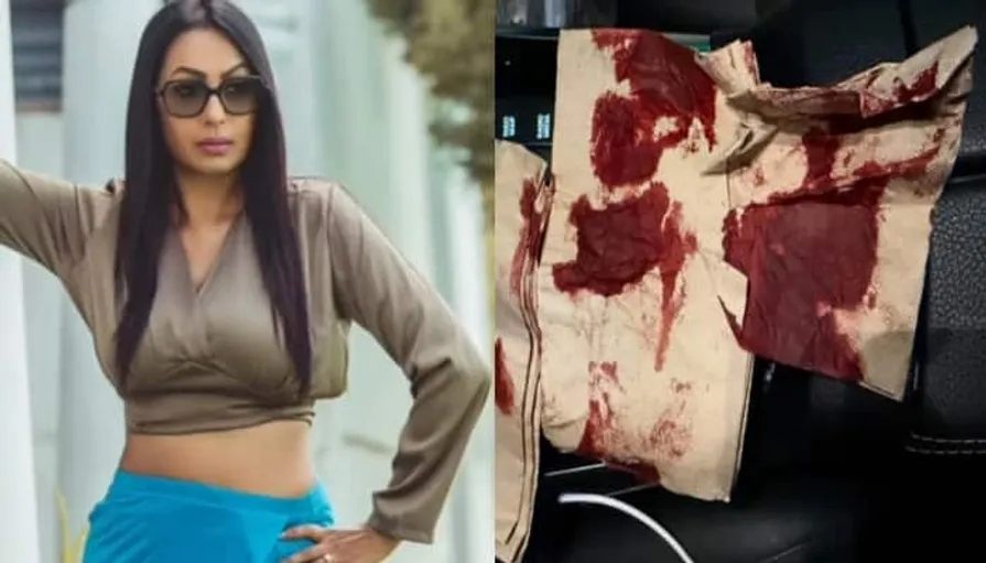 Actress Kashmera Shah Meets With Accident; Says 'Thank u god...'