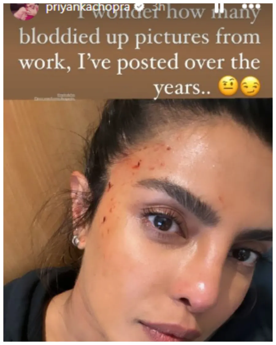 Priyanka Chopra got injured while shooting for Heads of State. 