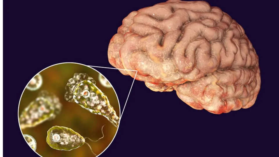 brain-eating amoeba