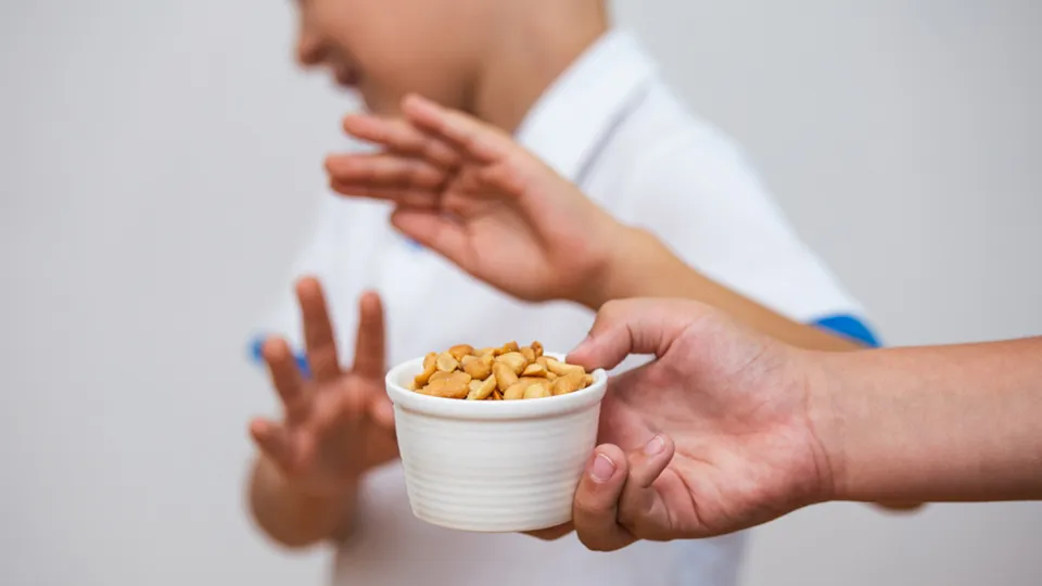 food allergies among children