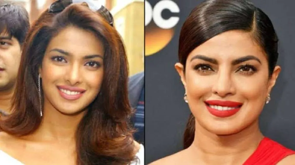 Priyanka Chopra had paid a big price for the wrong nose surgery was removed  from so many films | प्रियंका चोपड़ा ने नाक की गलत सर्जरी की चुकाई थी बड़ी  कीमत, इतनी