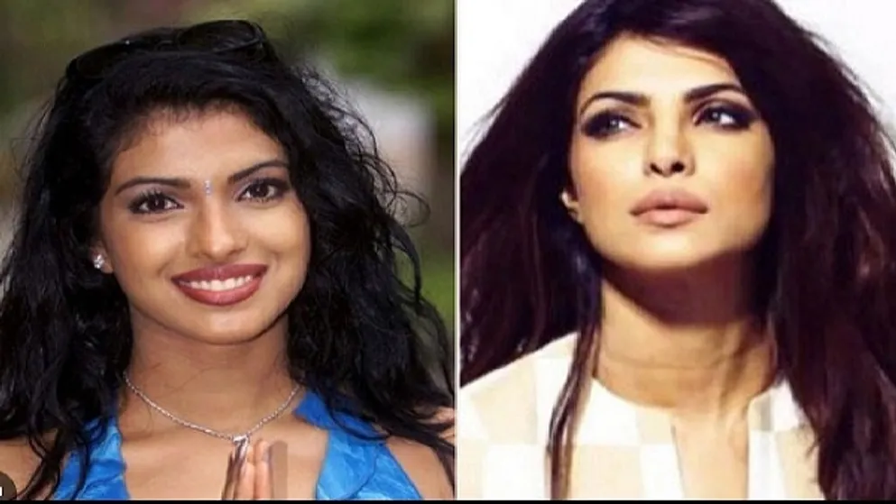 नाक की सर्जरी' के बाद प्रियंका चोपड़ा की हो गई थी ऐसी हालत, एक्ट्रेस को  फिल्मों से निकाल दिया था और फिर..... | priyanka chopra birthday her bad  condition after nose surgery